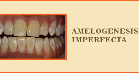 Amelogenesis Imperfecta: Symptoms, Causes, and Treatment