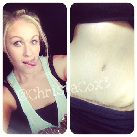 :: Christa Cox ::: Preparing For A Tummy Tuck! {Tips, Tricks, & What to Expect}