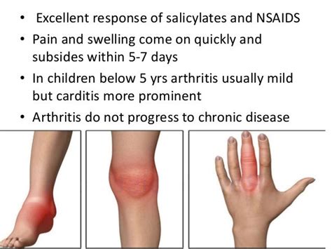 Acute rheumatic fever