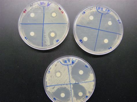 DVC Microbiology 146 Fall 11 (Gard): Lab 12: Control of Growth