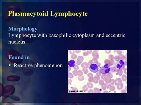 Practical Hematology Lab WBCs PLT Abnormal Morphology Platelet