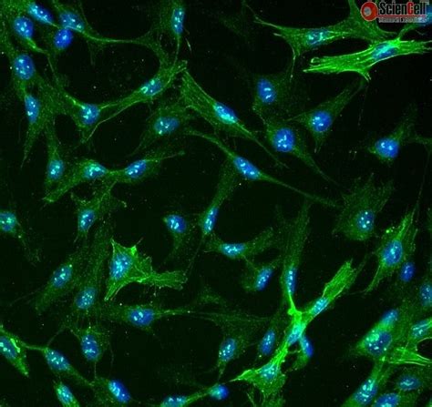 Human Hepatic Stellate Cells, HHSteC