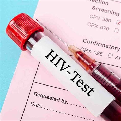 Free and Anonymous HIV Testing Available