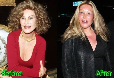 Catwoman Plastic Surgery: From Bad To Worse