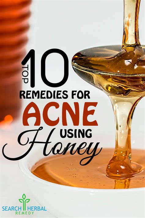 Top 10 Remedies For Acne Using Honey | Search Herbal & Home Remedy