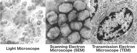 Electron Microscope: How Does An Electron Microscope Work?