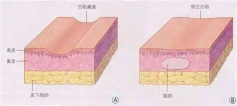 这些医美方法让你比同龄人年轻10岁！_皮肤