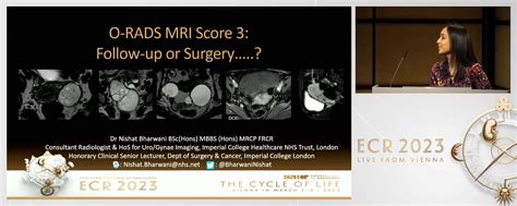 O-RADS MRI: where are we and where are we going - ESR Connect