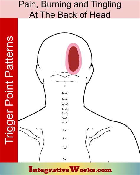 コンプリート！ back head pain 137925-Back head pain symptoms - Saesipapictur2