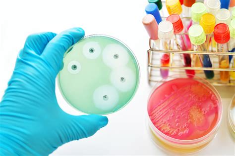 Experts have mapped levels of antimicrobial resistance worldwide ...