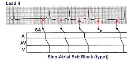 ECG Learning Center - An introduction to clinical electrocardiography