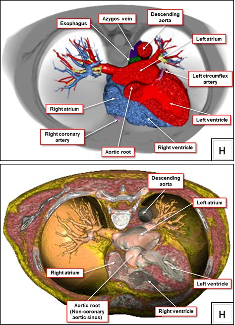 Esophagus Heart Anatomy