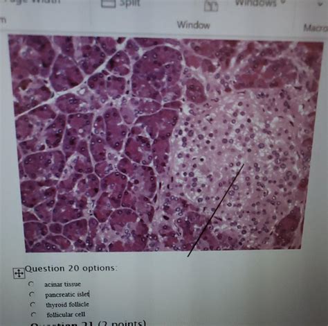 Solved Question 24 options: Pectinate Muscle Chordae | Chegg.com