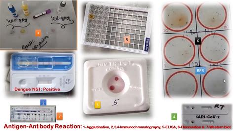 Antigen-Antibody Reaction Based Tests: Introduction, Types with Descripti