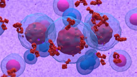 Physiotherapy in Multiple Myeloma Treatment