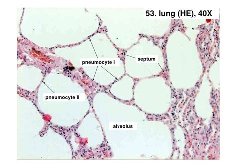 Lungs Histology Slides Labeled