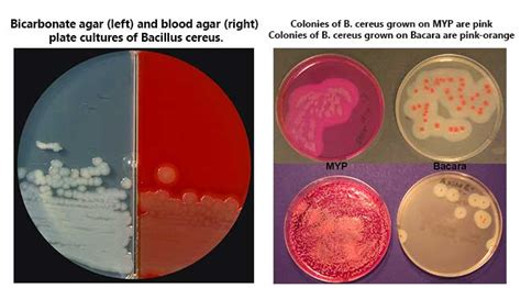 Bacillus cereus- An Overview - Microbe Notes