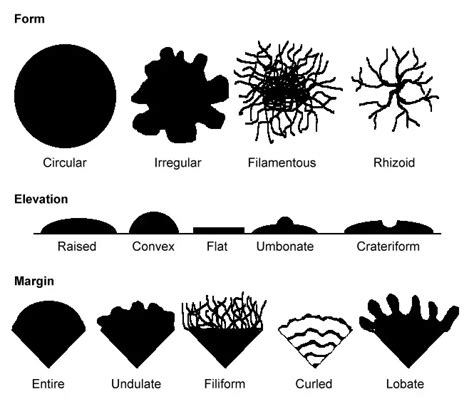 Colony Morphology of Bacteria – Microbe Online