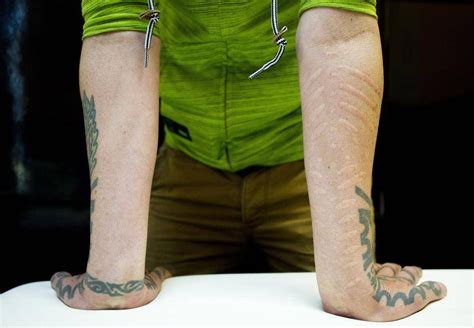 Scarification: The extreme body art that’s making a mark - The Globe and Mail