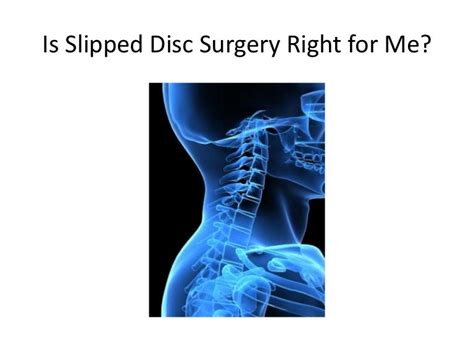 Slipped Disc Surgery