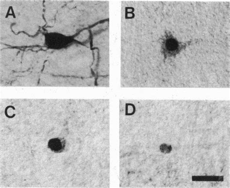 Calbindin-immunoreactive cells displayed a range of cellular staining ...