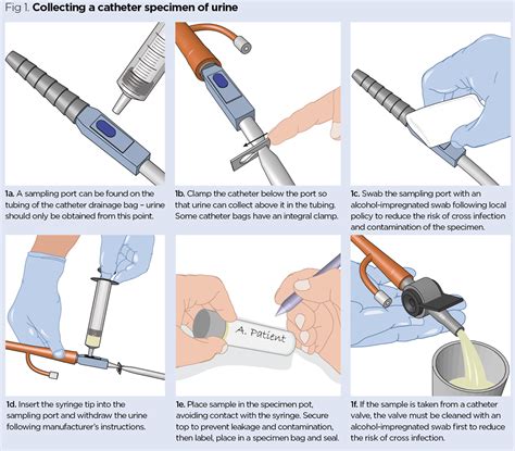 Catheter Urine Sample Collection Procedure for NMC OSCE Exam - OSCE Trainer