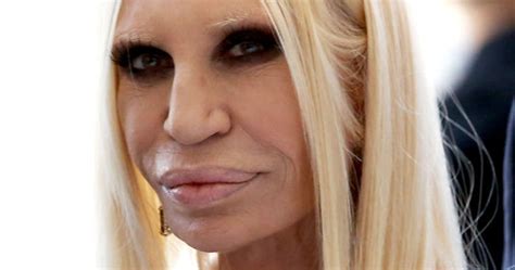 Donatella Versace After Surgery | Donatella Versace www.betr… | Flickr