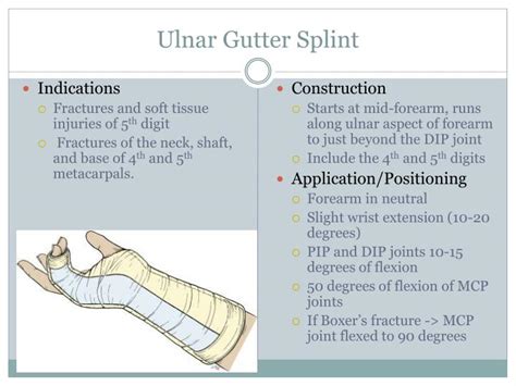 PPT - Procedures: Splinting PowerPoint Presentation - ID:2280962