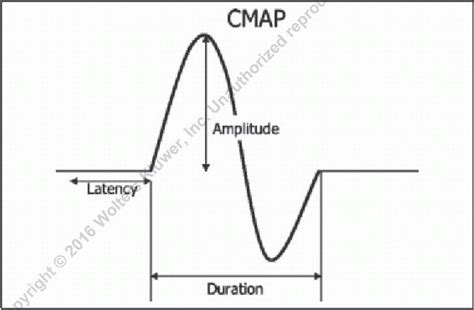 Nerve Conduction Studies and Electromyography | Neupsy Key