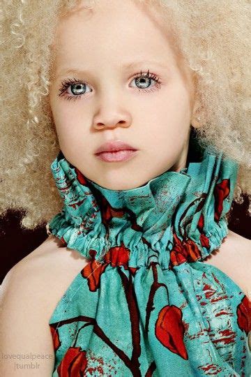 1ac6db20e956cdbfd2e7f66baf6693d0 | Albino women, Beautiful children, African albino