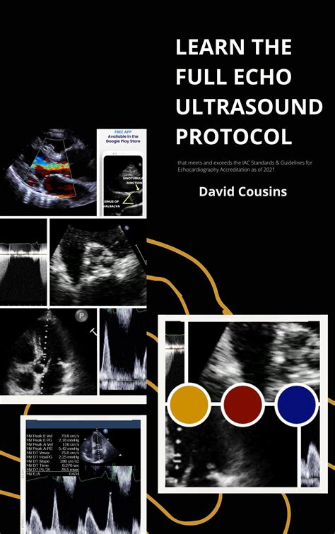 LEARN THE FULL ECHO TTE ECHOCARDIOGRAM ULTRASOUND PROTOCOL: : meets and exceeds the newly ...