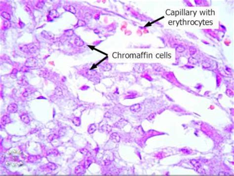 Adrenal Gland Histology - Adrenal medulla (labels) - histology slide