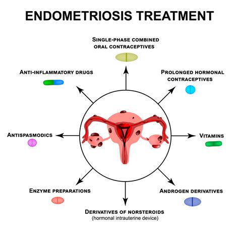 Endometriosis Treatment