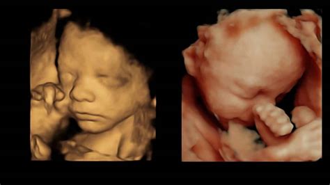 Our 3D/4D Scan Explained - Window to the Womb