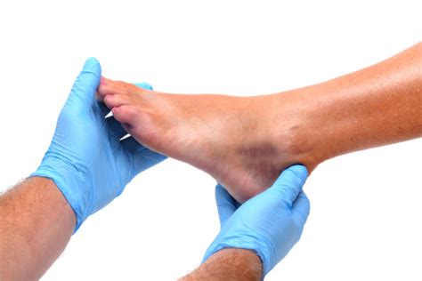 Diabetes, gangrene and diabetic foot amputation risks, causes and prevention