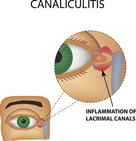 Cosmetic eyelid surgery, oculofacial Oculo-facial) surgeon locate