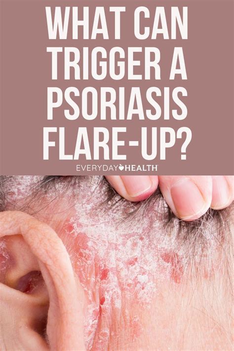 What is psoriasis symptoms causes diagnosis treatment and prevention ...