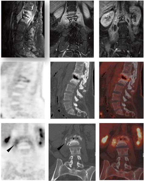 Row 1 depicts sagittal and coronal gadolinium-enhanced MR images at the... | Download Scientific ...