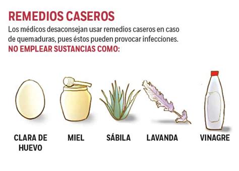 Quemaduras: No uses remedios caseros - SISAEM.ORG - Medicina