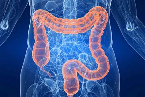 Colon Health Diet For A Healthy Colon | HealthSpectra