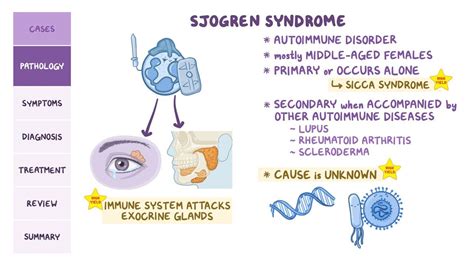 Sjogren syndrome: Pathology review: Video & Anatomy | Osmosis