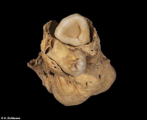 Tumor with TEETH is discovered in Egypt among remains of ancient woman who died more than 3,000 ...