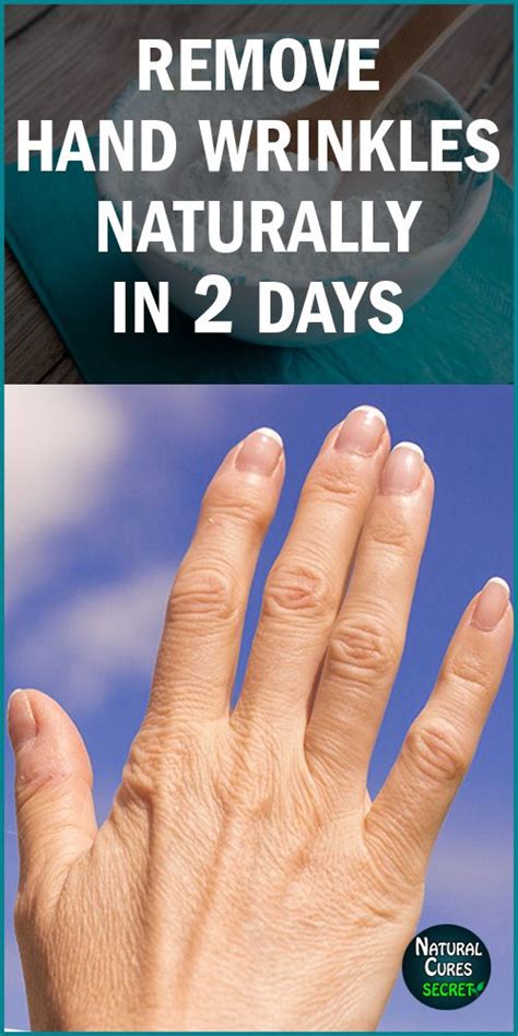 How To Remove Wrinkles From Hands Naturally in 2 Days! | Skin care ...