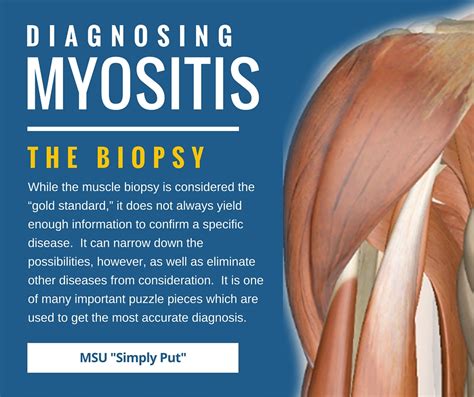 Myositis - Expose Forum Photo Galery