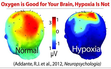 HYPOXIA IN FLIGHT - Aviation Ideas and Discussion!