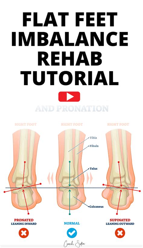 Fix Flat Feet With This One Simple Exercise - Coach Sofia Fitness