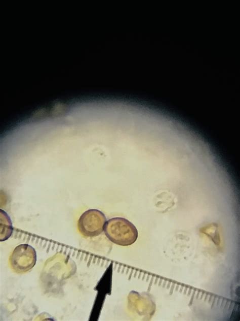 Examination under microscope - Identification Discussion - The Hoosier Mushroom Society