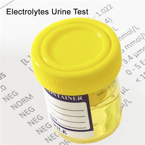 Electrolytes Urine Test | Blood Tests in London