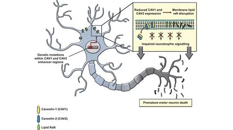 Stem Cell Treatment for Motor Neuron Disease (MND) | Swiss Medica