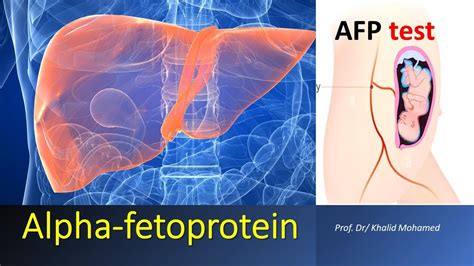 Alpha fetoprotein test (AFP) made easy - YouTube